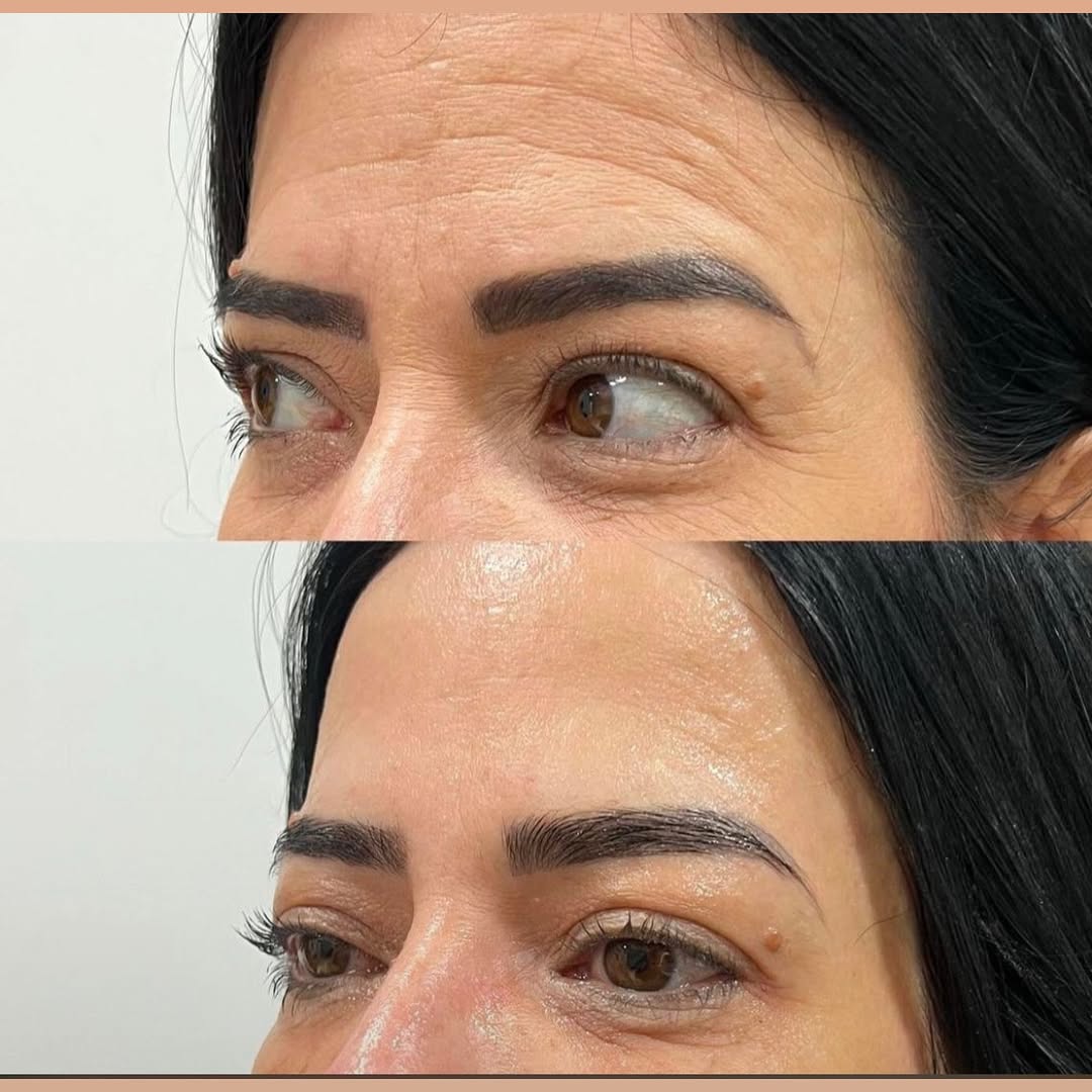 Prevenção e Rejuvenescimento - Antes e Depois